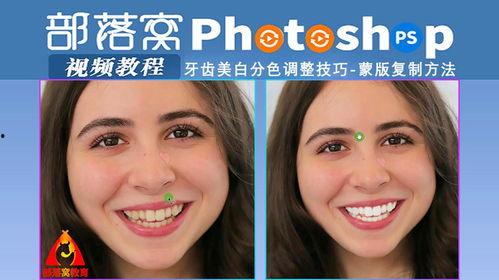 美白牙齿视频,跟随视频轻松拥有亮白笑容